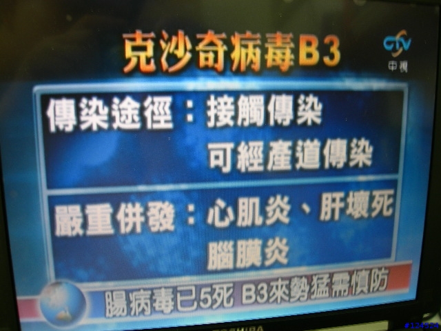 康博 U2200 + A300魚骨天線