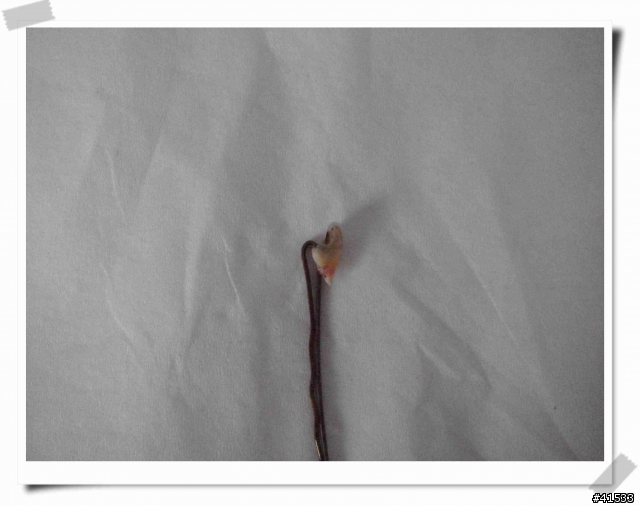 自行拔牙恐怖爆笑劇>.<"(附牙齒遺照)