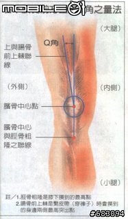 【勸敗分享】髕骨固定帶