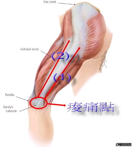 膝蓋痠痛症狀~個人復健過程分享