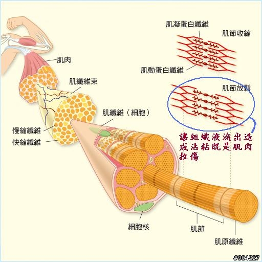 (Athletes’ Performance )冰敷對於急性傷害的保護及訓練後的保養是相當重要的一環