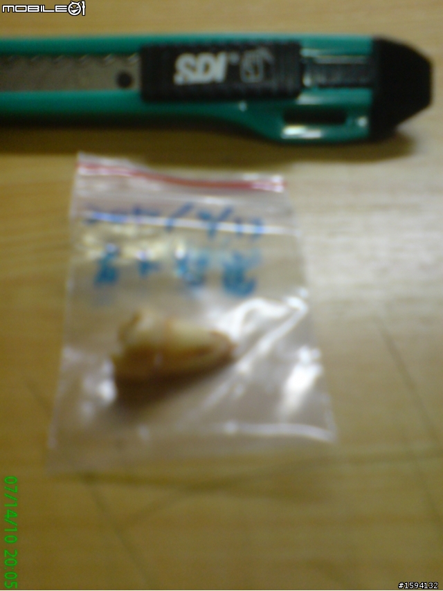 有智齒血肉照之開刀拔除水平智齒&before vs. after照片