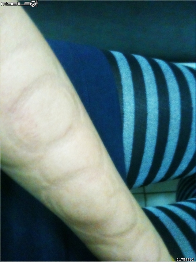 第一次拔罐就上手(?)