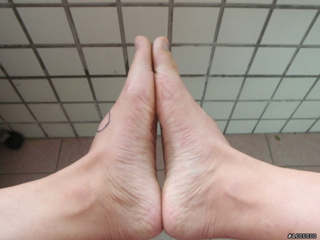 跑步左腳背會痛(附圖) 該如何處裡