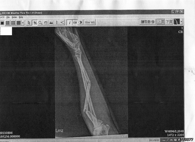 將被禁足一年,騎車請要小心。