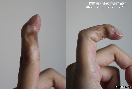 別讓孩子玩插頭‧不然就變這樣囉!!