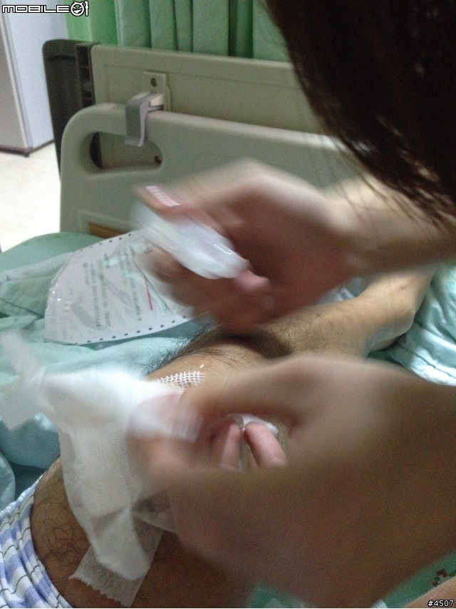 我的慘痛經驗,騎車要戴安全帽