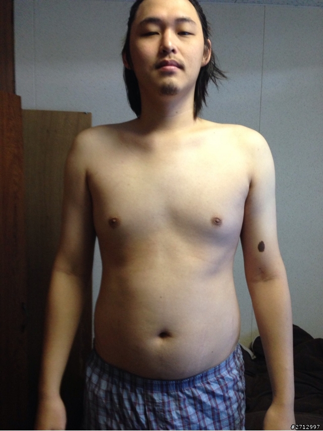 我想和大家分享一個21歲高血壓的故事