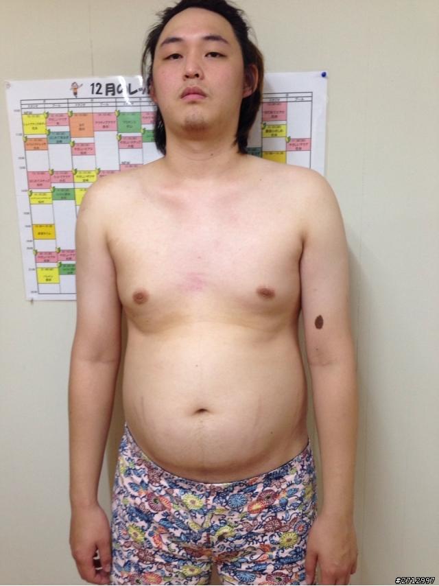 我想和大家分享一個21歲高血壓的故事