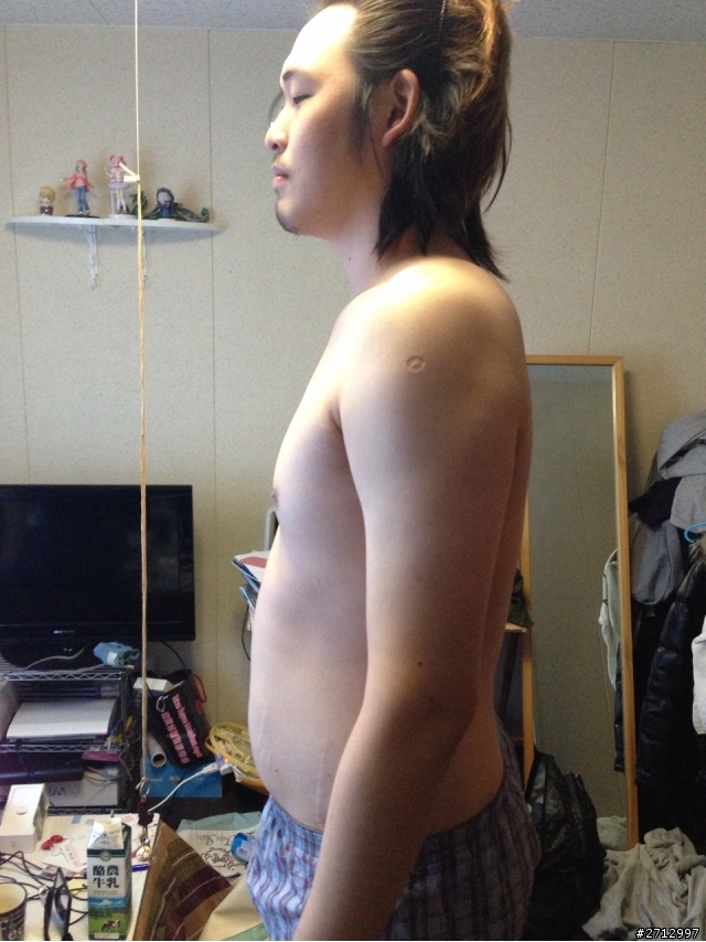 我想和大家分享一個21歲高血壓的故事