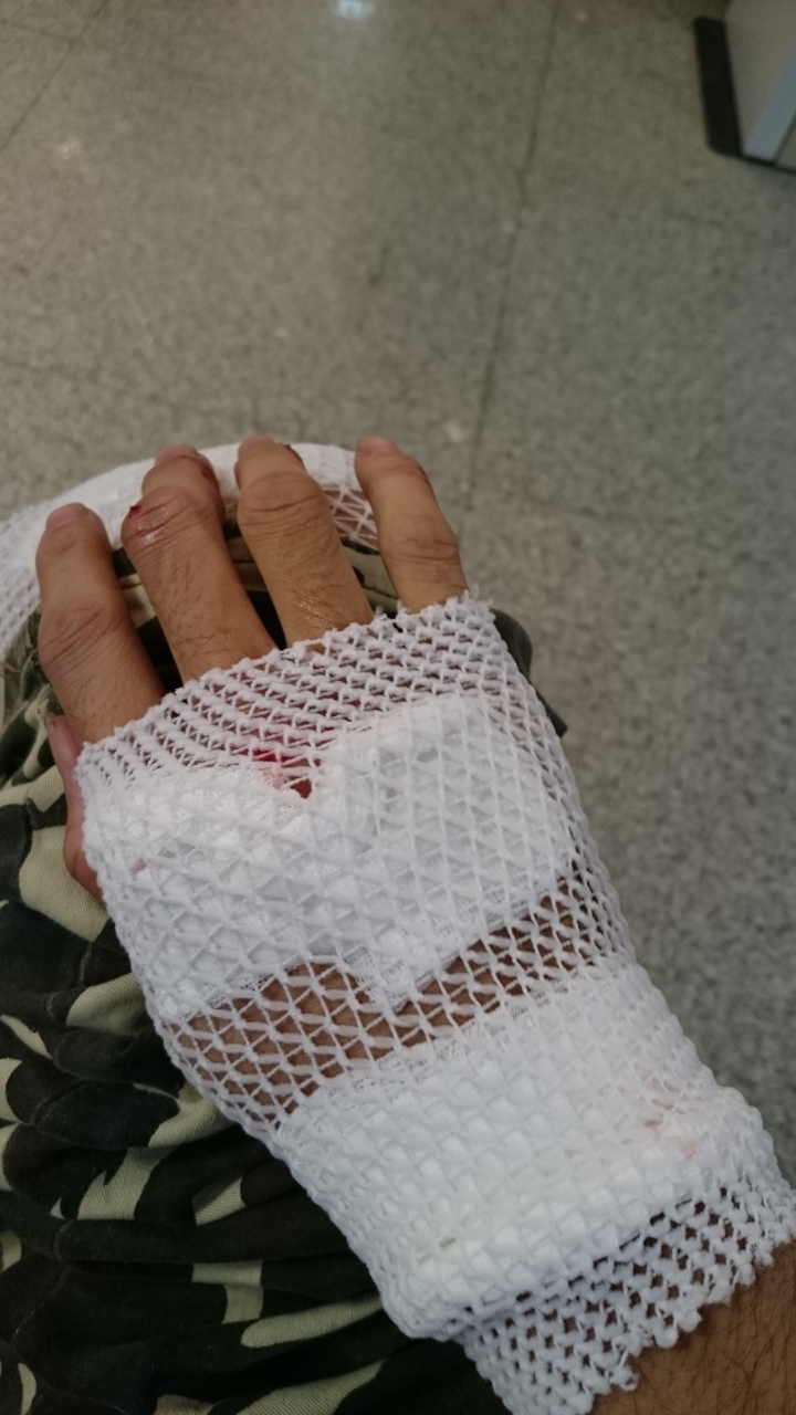 對方轉灣不注意…所以我飛走了…糟糕掉了一根門牙…還有兩顆搖搖欲墜囧