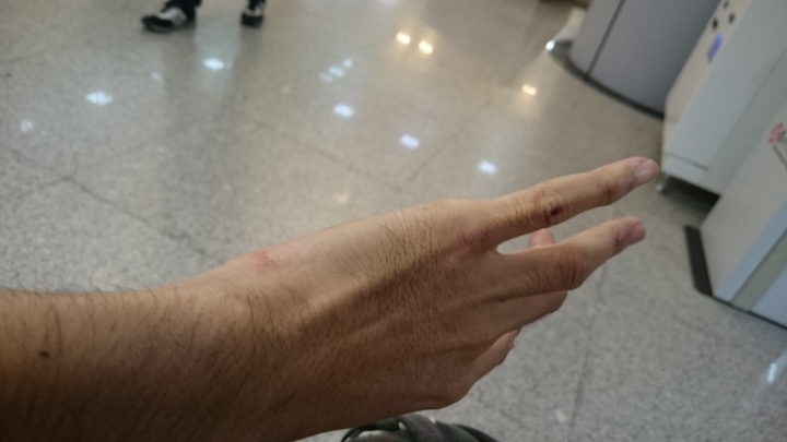 對方轉灣不注意…所以我飛走了…糟糕掉了一根門牙…還有兩顆搖搖欲墜囧