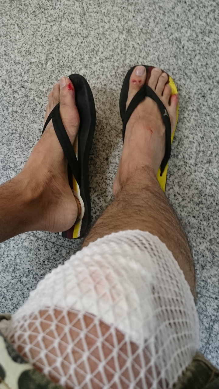 對方轉灣不注意…所以我飛走了…糟糕掉了一根門牙…還有兩顆搖搖欲墜囧