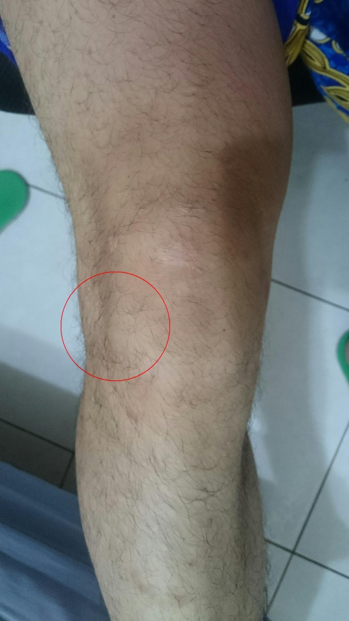 我右腳膝蓋感覺怪怪的= =''