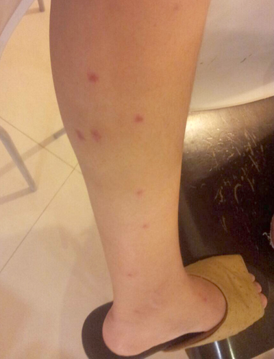 史上最強防蚊懶人包!管你家蚊、小黑蚊~我呸!