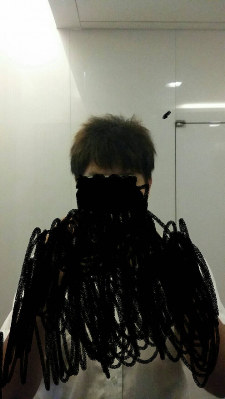 一個以前嚴重掉髮給中醫治療的過程,大家可嚐試中醫(健保)