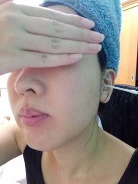 使用杏仁酸煥膚一週心得