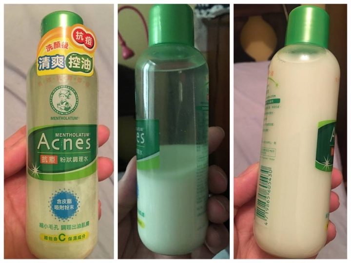 兩款消痘水兩頰試用-曼秀雷敦V.S豔容露