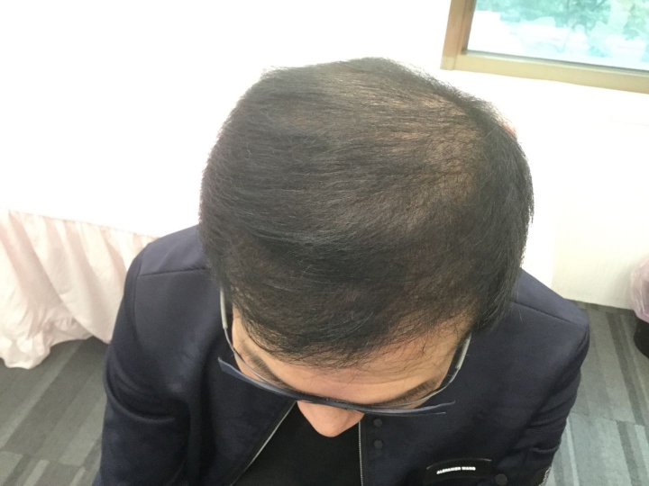 2017年生髮大挑戰