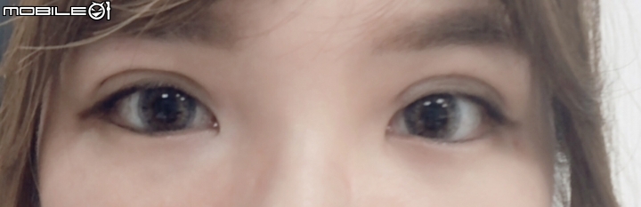 七年前縫完掉了~~重縫雙眼皮分享