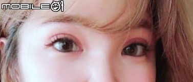 七年前縫完掉了~~重縫雙眼皮分享