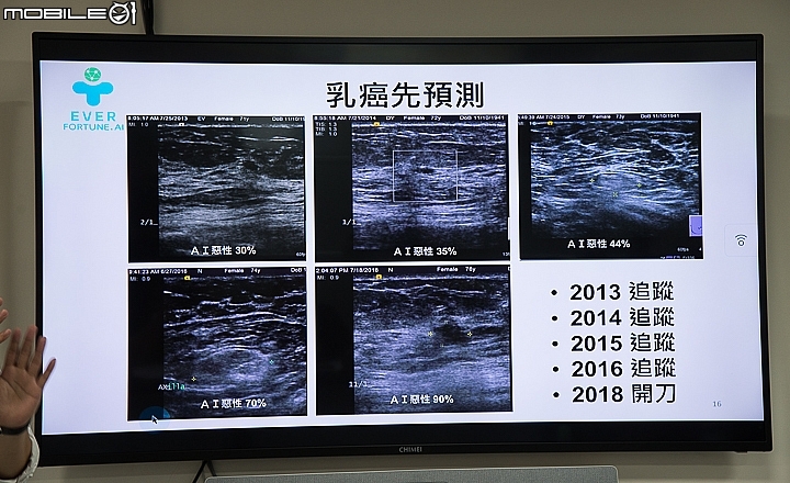 中國醫與長佳智能導入全亞洲首台NVIDIA DGX-2 系統 加速醫療AI發展與應用