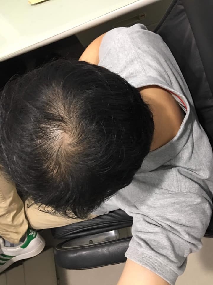 育髮療程