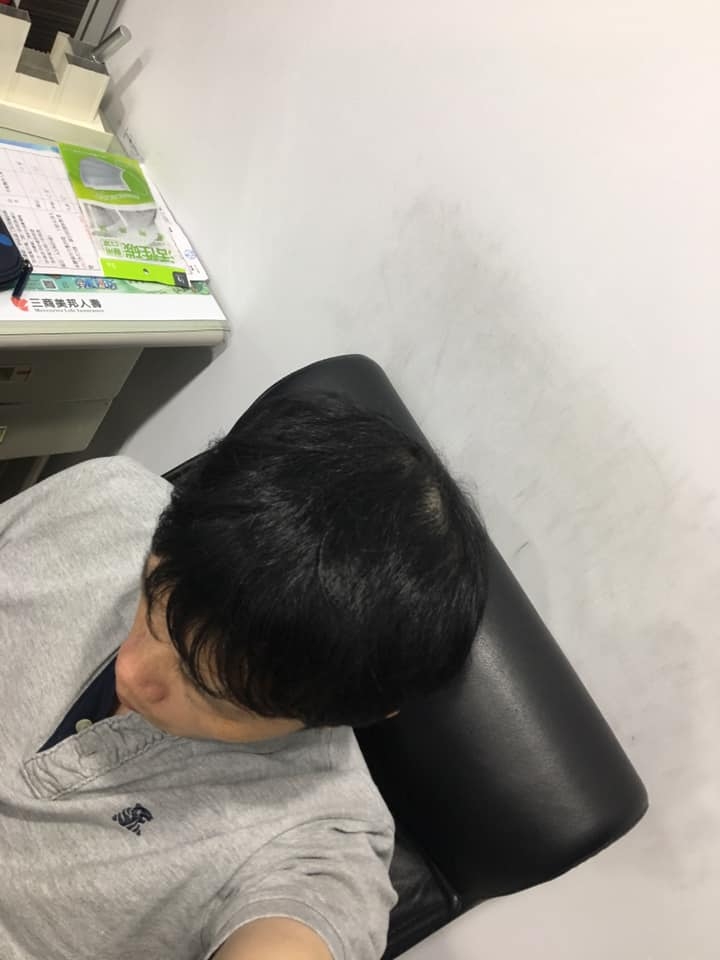 育髮療程