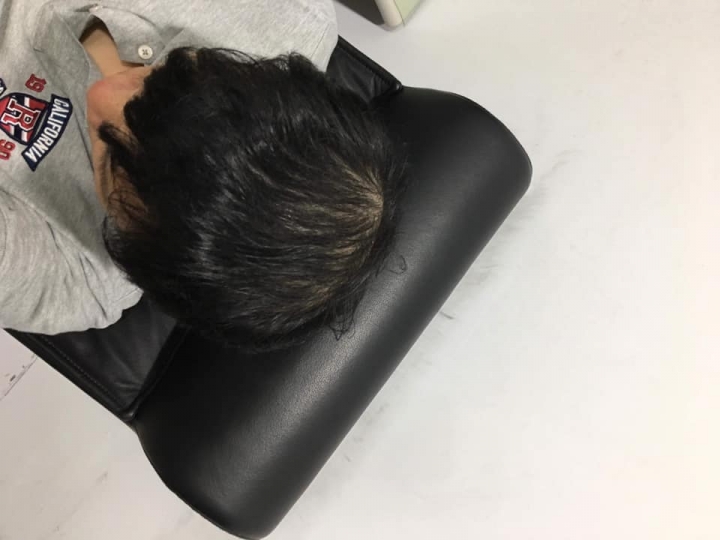 育髮療程