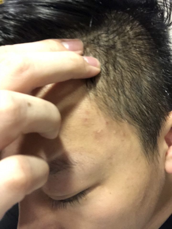 效果不錯的法國蔻蘿蘭三效養髮精華液