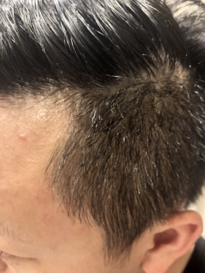 效果不錯的法國蔻蘿蘭三效養髮精華液