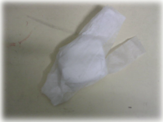 [胖丁-分享]誰說01只有勸敗~其實也是有勸戒的:"針眼的介紹與處理的方式!"
