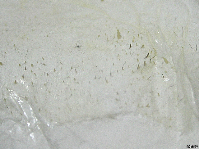 [分享]打擊粉刺！elsagusa膠原蛋白拔粉刺亮鼻貼！