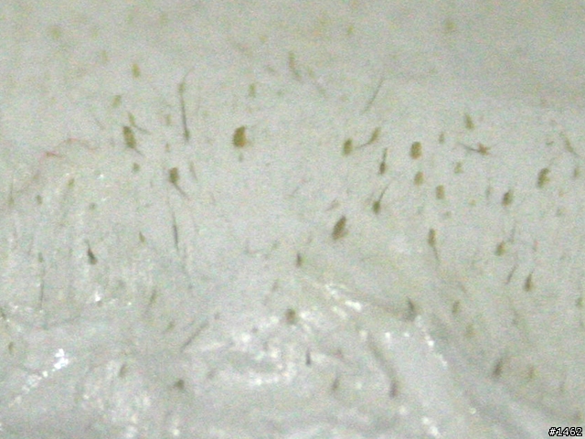 [分享]打擊粉刺！elsagusa膠原蛋白拔粉刺亮鼻貼！