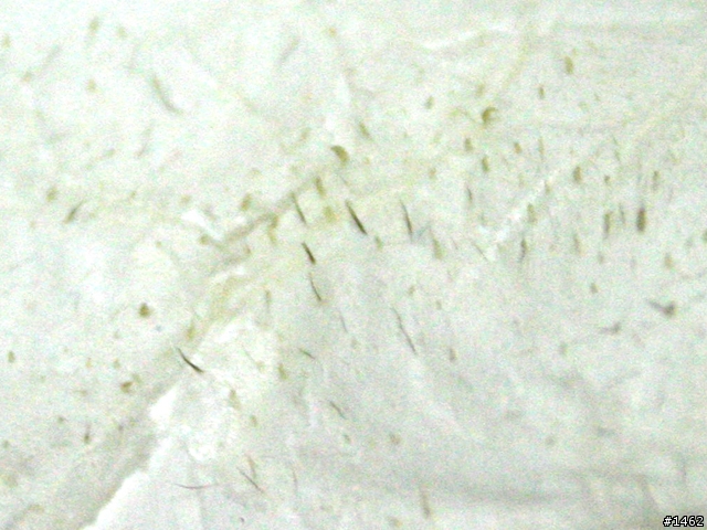 [分享]打擊粉刺！elsagusa膠原蛋白拔粉刺亮鼻貼！
