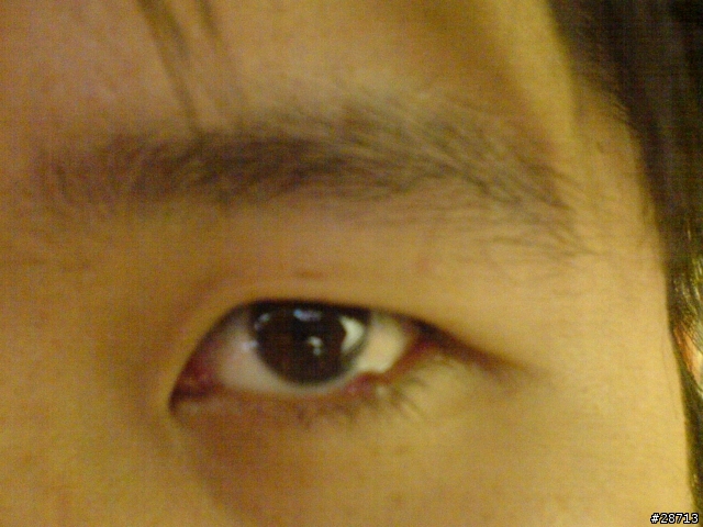 點痣需要掛醫院哪一科@@?