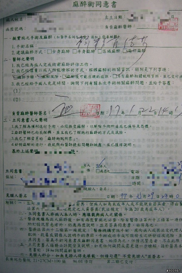 結紮