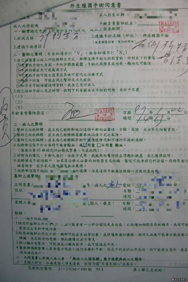 結紮