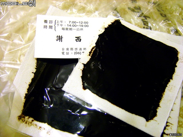 [尋求建議]腳好像快毀了以後不能騎車怎辦.(後續處理報告