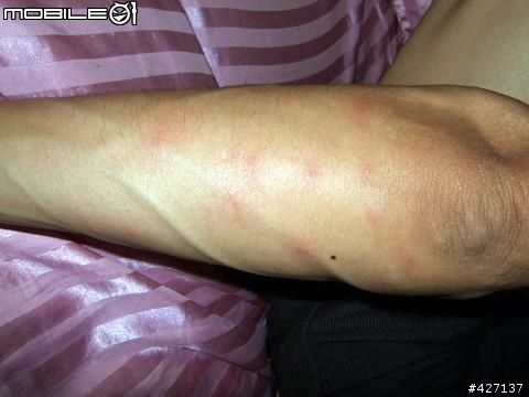 惱人的小黑蚊(黑金剛?)