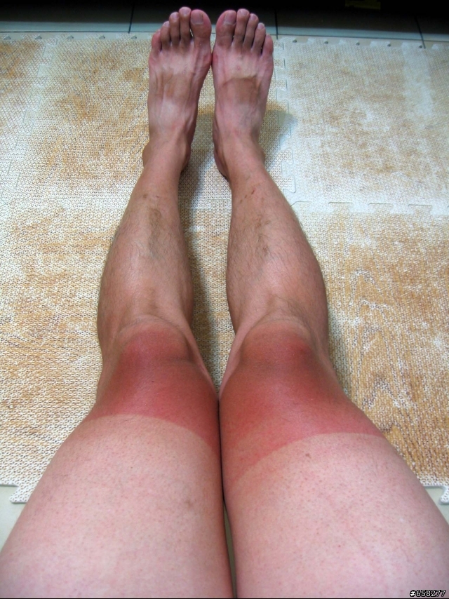 炎夏騎車之人體慘繪