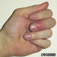 天啊~  "當尬"    怎麼處理??