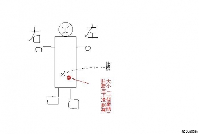 救命..肚臍的左下邊劇痛？？怎辦
