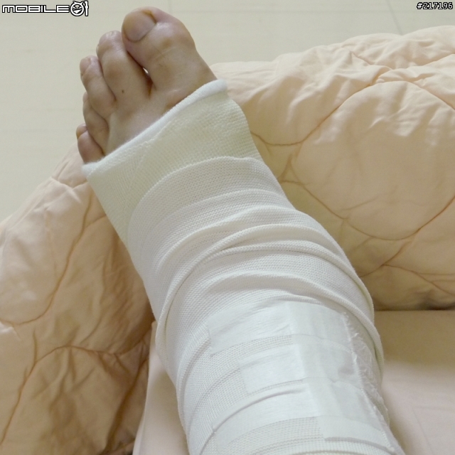 【病號】世事難預料~請好好保護自己~摔車斷骨想騎車要半年後再說~