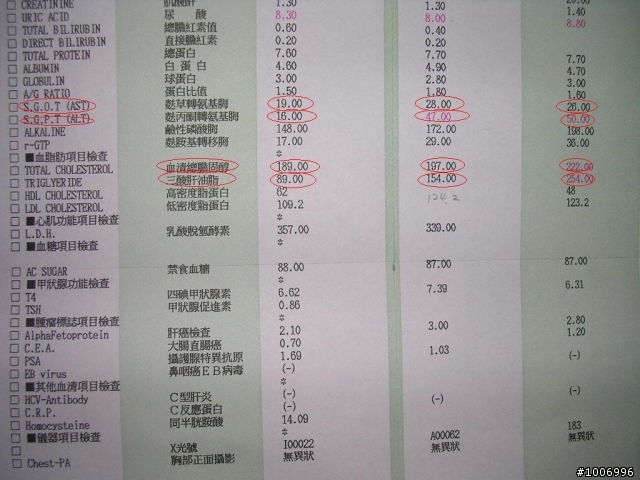 體檢報告:一年來騎單車的成果