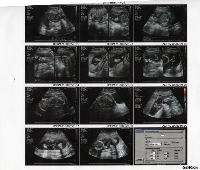 高層次超音波的疑問 第2頁 Mobile01