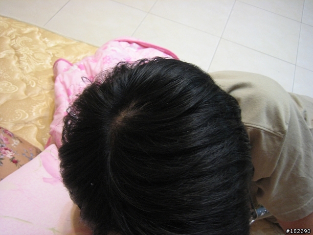 這樣的髮量有問題嗎?