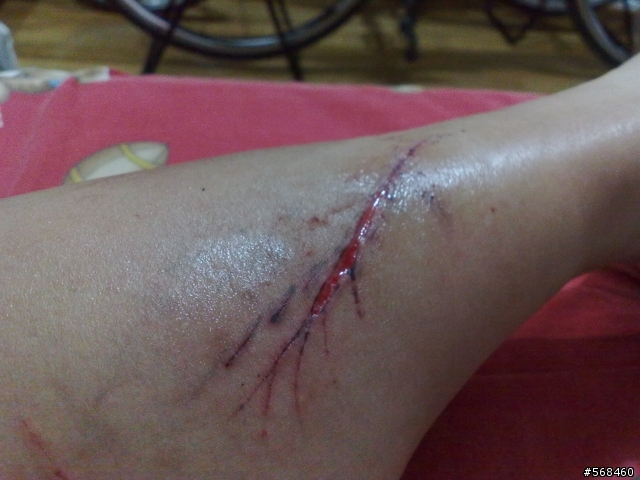 (內含血腥畫面,慎入!)才看完被大盤斷腳筋的文章沒想到....