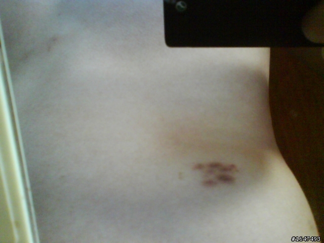 嗯，我中鏢了  有圖~請慎