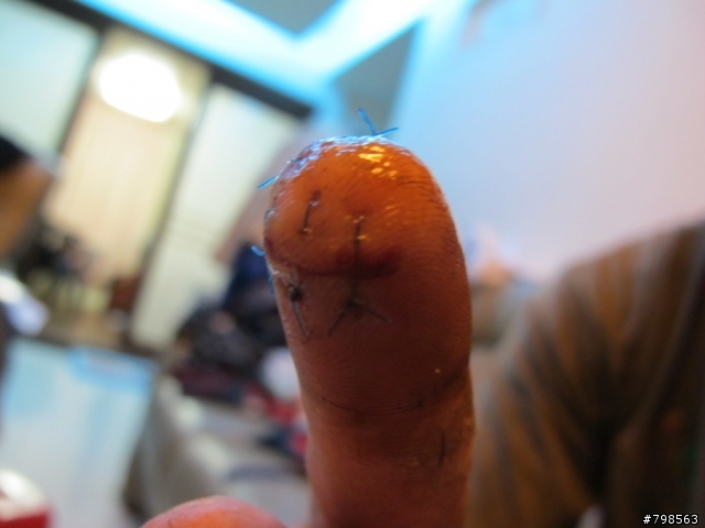 騎車釐田後的好東西...XD  (內有血腥照片...不喜勿入Orz)